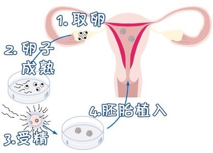 胚胎专家